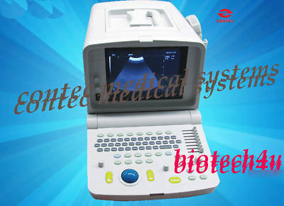 3.5MHZ convex portable b-ultrasound machine scanner