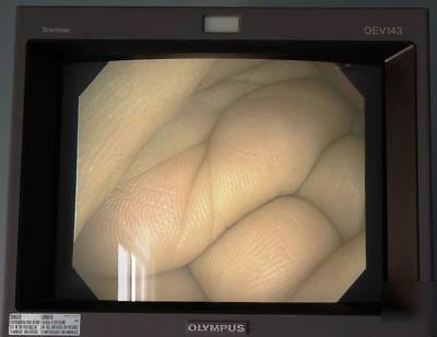 Olympus evis exera cf-Q160L video colonoscope cf q 160L
