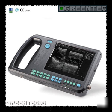 Palmsmart ultrasound scanner ultrasound machine convex 