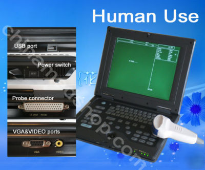 Laptop ultrasound machine scanner convex & linear probe
