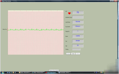 Handheld portable ecg ekg monitor MD100B - fda approved