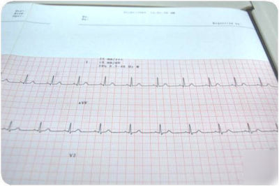 Hp pagewriter xli M1700A ecg ekg w/ software cart leads