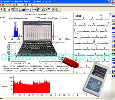 12-channel color lcd holter recorder + holter analyzer