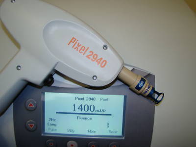 Alma harmony pixel erbium fractional handpiece 9MM tip